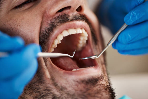 Best Chipped Tooth Repair Near Me  in USA